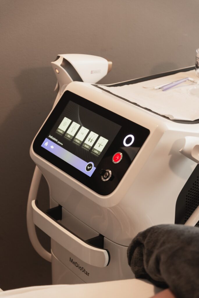 epilazione laser